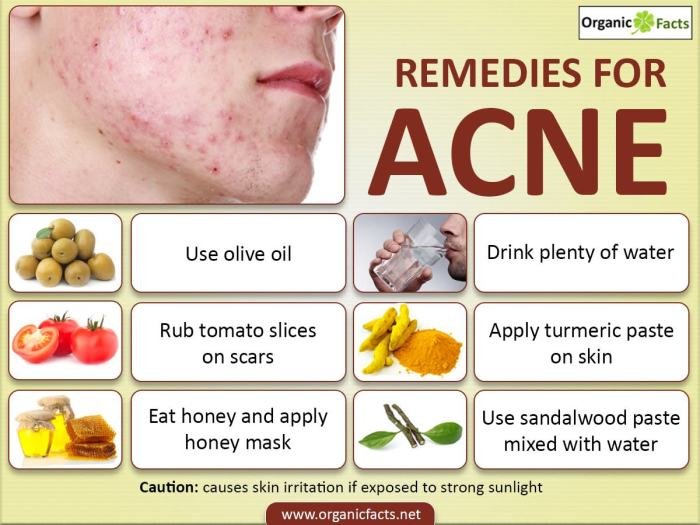 Acne scars heal treating