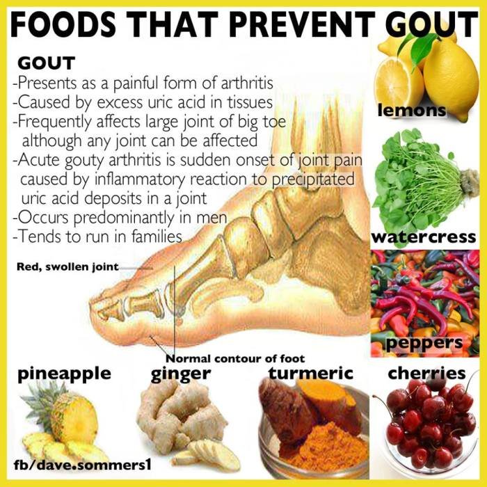 Gout diet purine recipes foods food arthritis low uric acid remedies prevention treatment good health cure prevent causes relief board