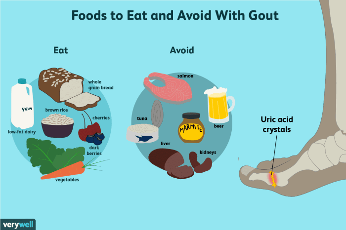 High foods avoid purine gout